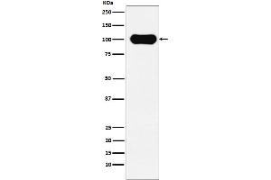 Western blot analysis of FE65 expression in SH-SY5Y cell lysate.