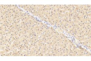 Detection of GRN in Human Liver Tissue using Polyclonal Antibody to Granulin (GRN) (Granulin Antikörper  (AA 361-585))