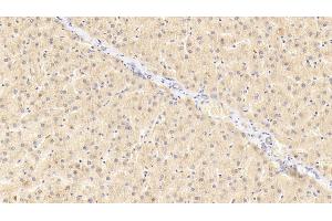 Detection of GRN in Human Liver Tissue using Polyclonal Antibody to Granulin (GRN)