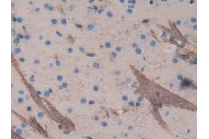 IHC-P analysis of Mouse Cerebrum Tissue, with DAB staining. (Aggrecan Antikörper  (AA 587-684))