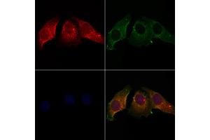ABIN7094110 and ABIN7098154 staining Hela cells by IF/ICC. (CALU Antikörper  (Internal Region))