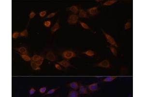Immunofluorescence analysis of NIH-3T3 cells using POR Polyclonal Antibody at dilution of 1:100 (40x lens). (POR Antikörper)