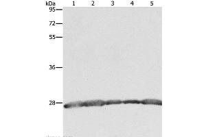 Western Blot analysis of Hela, 293T and MCF7 cell, Human fetal brain tissue and Jurkat cell using PRDX3 Polyclonal Antibody at dilution of 1:800 (Peroxiredoxin 3 Antikörper)
