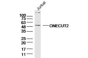 Jurkay lysates probed with ONECUT2 Polyclonal Antibody, Unconjugated  at 1:300 overnight at 4˚C.