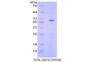 SDS-PAGE (SDS) image for serum/glucocorticoid Regulated Kinase Family, Member 3 (SGK3) (AA 141-368) protein (His tag) (ABIN2126733) (SGK3 Protein (AA 141-368) (His tag))