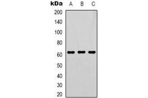 Western blot analysis of GTF2H1 expression in Hela (A), Jurkat (B), PC3 (C) whole cell lysates.