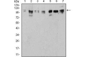Western Blotting (WB) image for anti-Unc-51 Like Kinase 2 (ULK2) (AA 1-155) antibody (ABIN5882566) (ULK2 Antikörper  (AA 1-155))