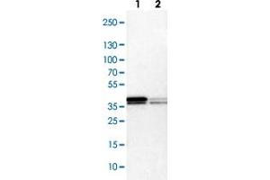 Western blot analysis of Lane 1: NIH-3T3 cell lysate (Mouse embryonic fibroblast cells), Lane 2: NBT-II cell lysate (Rat Wistar bladder tumour cells) with HNRNPA2B1 polyclonal antibody . (HNRNPA2B1 Antikörper)