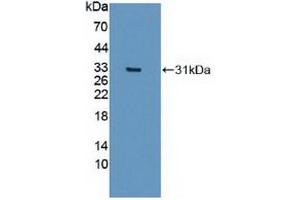 Detection of Recombinant IREB2, Human using Polyclonal Antibody to Iron Responsive Element Binding Protein 2 (IREB2) (IREB2 Antikörper  (AA 39-281))