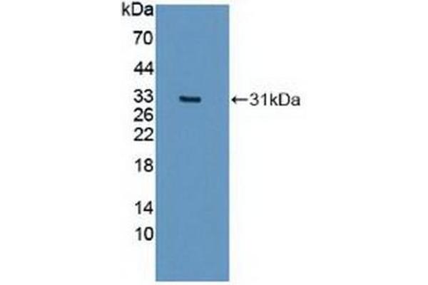 IREB2 Antikörper  (AA 39-281)