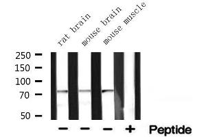 Western blot analysis of extracts of various tissue ,using ACSA antibody (ACSS2 Antikörper  (N-Term))