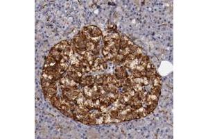 Immunohistochemical staining of human pancreas with STX3 polyclonal antibody  shows strong cytoplasmic positivity in islet cells at 1:200-1:500 dilution. (STX3 Antikörper)