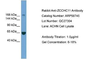 WB Suggested Anti-ZCCHC11  Antibody Titration: 0. (ZCCHC11 Antikörper  (Middle Region))