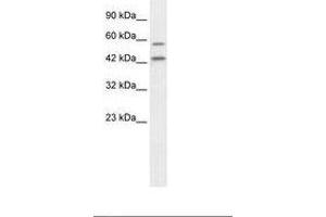 Image no. 2 for anti-Autophagy related 4B Cysteine Peptidase (ATG4B) (C-Term) antibody (ABIN6735868) (ATG4B Antikörper  (C-Term))