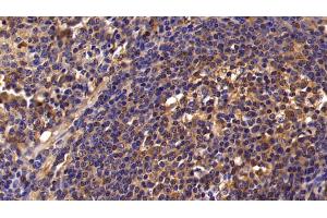 Immunohistochemistry (IHC) image for anti-Interleukin 8 (IL8) (AA 23-101) antibody (ABIN7429835)