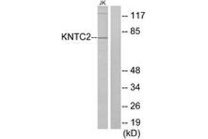 Western blot analysis of extracts from Jurkat cells, using KNTC2 Antibody. (NDC80 Antikörper  (AA 351-400))