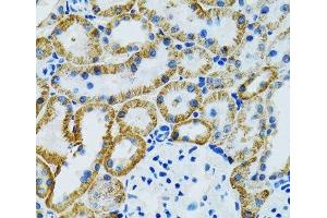 Immunohistochemistry of paraffin-embedded Mouse kidney using GDAP1 Polyclonal Antibody at dilution of 1:100 (40x lens). (GDAP1 Antikörper)