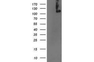 HEK293T cells were transfected with the pCMV6-ENTRY control (Left lane) or pCMV6-ENTRY ERCC4 (Right lane) cDNA for 48 hrs and lysed. (ERCC4 Antikörper)