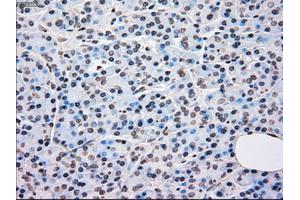 Immunohistochemical staining of paraffin-embedded Kidney tissue using anti-BRAFmouse monoclonal antibody. (BRAF Antikörper)