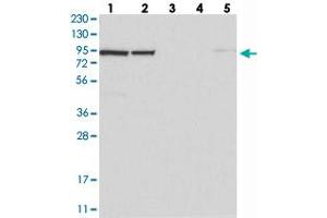 Western blot analysis of Lane 1: RT-4, Lane 2: U-251 MG, Lane 3: Human Plasma, Lane 4: Liver, Lane 5: Tonsil with UFL1 polyclonal antibody  at 1:250-1:500 dilution. (UFL1 Antikörper)