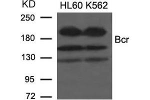 Western blot analysis of extracts from HL60 and K562 cells using Bcr(Ab-177) Antibody. (BCR Antikörper)