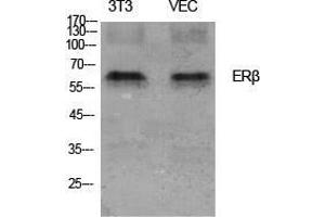 Western Blot (WB) analysis of specific cells using ERbeta Polyclonal Antibody. (ESR2 Antikörper  (Ser367))