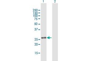 Western Blot analysis of C11orf17 expression in transfected 293T cell line by C11orf17 MaxPab polyclonal antibody. (AKIP1 Antikörper  (AA 1-210))