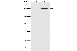 Western blot analysis of Phospho-GCN2 (Thr899) in (1) HeLa cell lysate, (2) HeLa cell lysate treated with Calyculin.