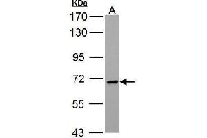 WB Image PCK2 antibody [C1C2], Internal detects PCK2 protein by Western blot analysis. (PEPCK Antikörper)
