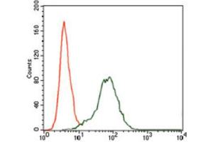 Immunohistochemical analysis of paraffin-embedded bladder cancer tissues using Insulin Like Growth Factor 2 (IGF2) antibody with DAB staining. (IGF2 Antikörper  (AA 25-180))