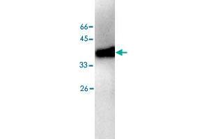 Western blot analysis of HEK293 whole cell lystae with ALDOB monoclonal antibody, clone 10  at 1:500 dilution. (ALDOB Antikörper)