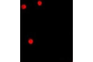 Immunofluorescent analysis of AEBP2 staining in A549 cells. (AEBP2 Antikörper)