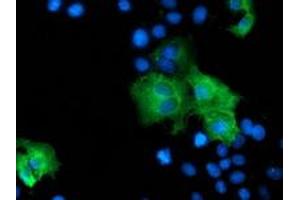Anti-ZFP36 mouse monoclonal antibody (ABIN2454212) immunofluorescent staining of COS7 cells transiently transfected by pCMV6-ENTRY ZFP36 (RC202049). (ZFP36 Antikörper)