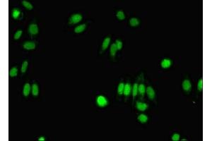 Immunofluorescent analysis of HepG2 cells using ABIN7143007 at dilution of 1:100 and Alexa Fluor 488-congugated AffiniPure Goat Anti-Rabbit IgG(H+L) (FIBP Antikörper  (AA 2-357))