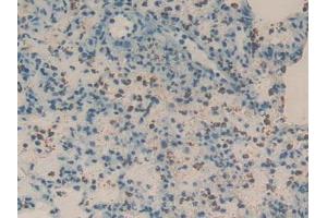 Immunohistochemistry (IHC) image for anti-Regenerating Islet Derived Protein 3 gamma (REG3g) (AA 33-147) antibody (ABIN7439174)