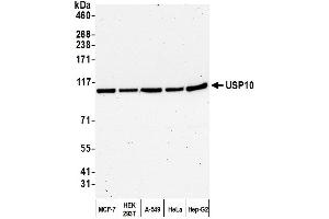 Western Blotting (WB) image for anti-Ubiquitin Specific Peptidase 10 (USP10) (AA 50-100) antibody (ABIN7453890) (USP10 Antikörper  (AA 50-100))