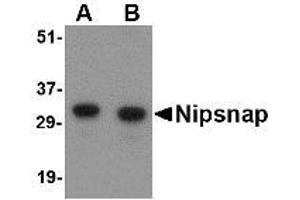 Image no. 1 for anti-4-Nitrophenylphosphatase Domain and Non-Neuronal SNAP25-Like Protein Homolog 1 (NIPSNAP1) (Internal Region) antibody (ABIN1493790) (NIPSNAP1 Antikörper  (Internal Region))