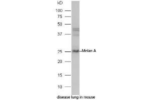 Mouse lung lysate probed with Rabbit Anti-Melan A Polyclonal Antibody, Unconjugated (ABIN2559583) at 1:300 in 4˚C. (MLANA Antikörper  (AA 1-80))