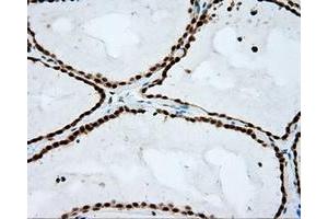 Immunohistochemistry (IHC) image for anti-Atrial Natriuretic Peptide Receptor 3 (NPR3) antibody (ABIN1499804) (NPR3 Antikörper)