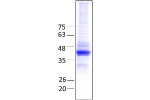 Aminoadipate Aminotransferase (AADAT) (AA 30 - 425), fraction 11 - 12