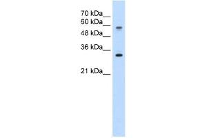 WB Suggested Anti-SLC22A1 Antibody Titration:  5.