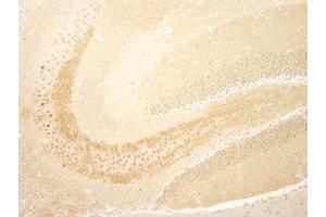 Immunohistochemistry (IHC) image for anti-CREB Regulated Transcription Coactivator 1 (CRTC1) (C-Term) antibody (ABIN7448839) (CRTC1 Antikörper  (C-Term))