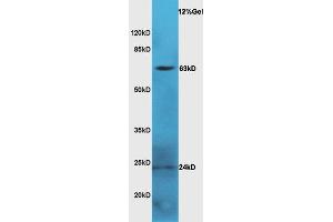 Mouse serum lysate probed with Anti LGALS3BP Polyclonal Antibody, Unconjugated  at 1:3000 for 90 min at 37˚C. (LGALS3BP Antikörper  (AA 301-400))