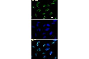 Histone H3 trimethyl Lys9 antibody tested by immunofluorescence. (Histone 3 Antikörper  (3meLys9))