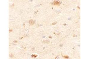 Immunohistochemical analysis of RAPGEF3 in rat brain tissue with RAPGEF3 polyclonal antibody  at 2. (RAPGEF3 Antikörper  (N-Term))