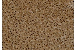 ABIN6273993 at 1/100 staining Rat liver tissue by IHC-P. (BCL6 Antikörper  (Internal Region))