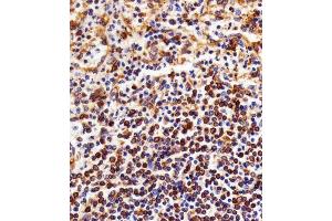 Immunohistochemistry (Paraffin-embedded Sections) (IHC (p)) image for anti-Nuclear Factor of kappa Light Polypeptide Gene Enhancer in B-Cells 1 (NFKB1) antibody (ABIN1882050)
