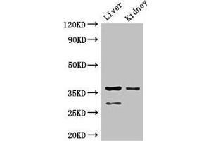 Western Blot Positive WB detected in: Mouse liver tissue, Mouse kidney tissue All lanes: PPP2CA antibody at 2. (PPP2CA Antikörper  (Catalytic Subunit alpha))