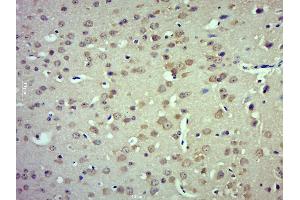 Paraformaldehyde-fixed, paraffin embedded mouse brain; Antigen retrieval by boiling in sodium citrate buffer (pH6. (TRPM4 Antikörper  (AA 800-850))