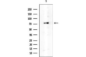 Western blot analysis of lysates from EC304 cells, using KIRREL2 Mouse Monoclonal Antibody at 1/1000 dilution.